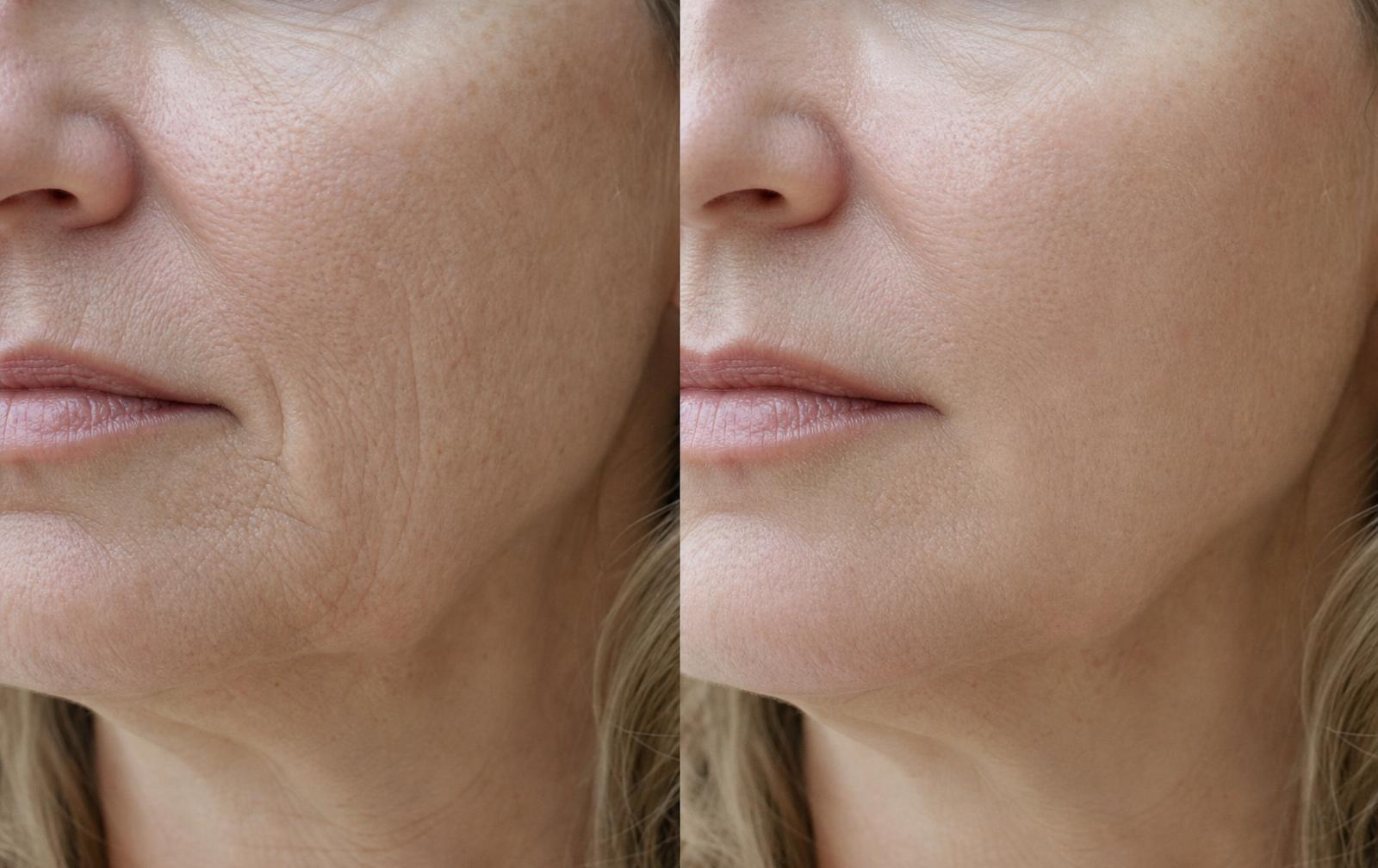 Before and after Satin Repair — Isabelle, 56 · mature skin